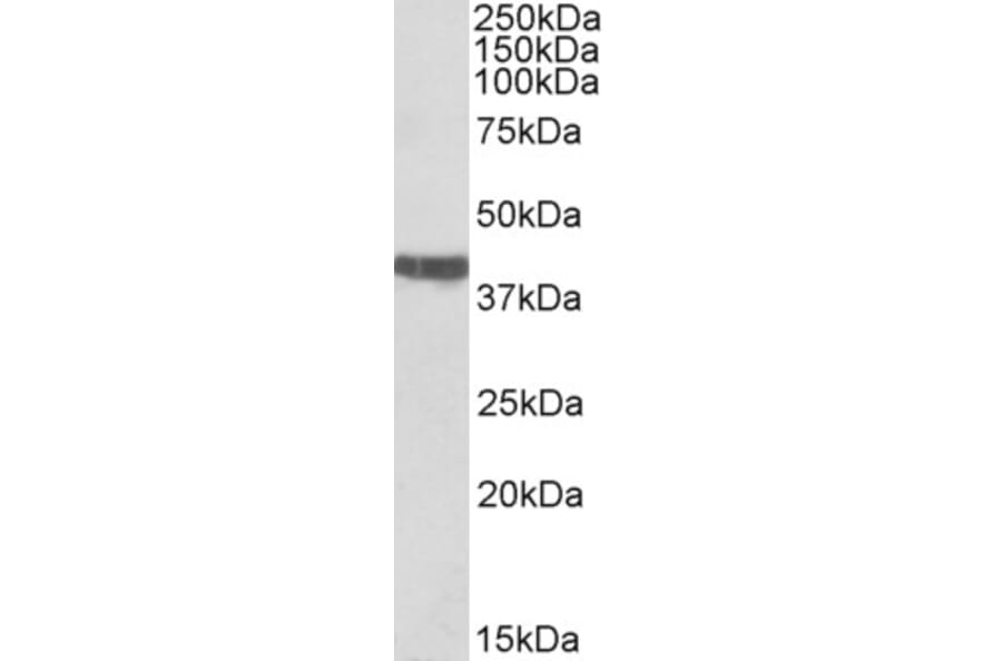 Western Blot - Anti-Cardiac Troponin T Antibody (A83133) - Antibodies.com