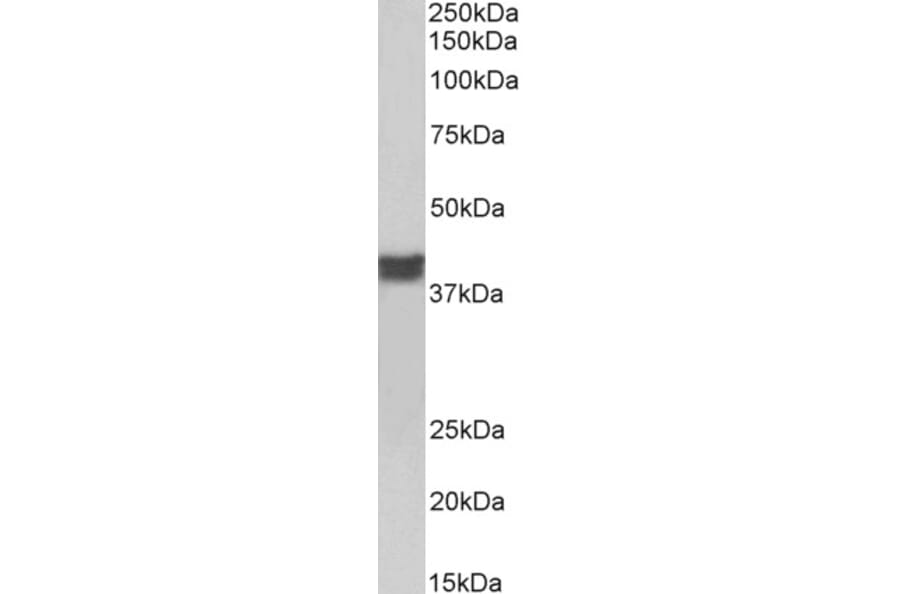 Western Blot - Anti-Cardiac Troponin T Antibody (A83133) - Antibodies.com