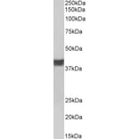 Western Blot - Anti-Cardiac Troponin T Antibody (A83133) - Antibodies.com