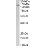 Western Blot - Anti-Patched/PTCH1 Antibody (A83134) - Antibodies.com