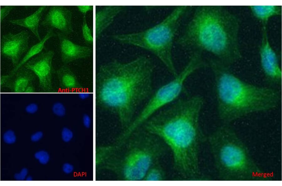 Immunofluorescence - Anti-Patched/PTCH1 Antibody (A83134) - Antibodies.com
