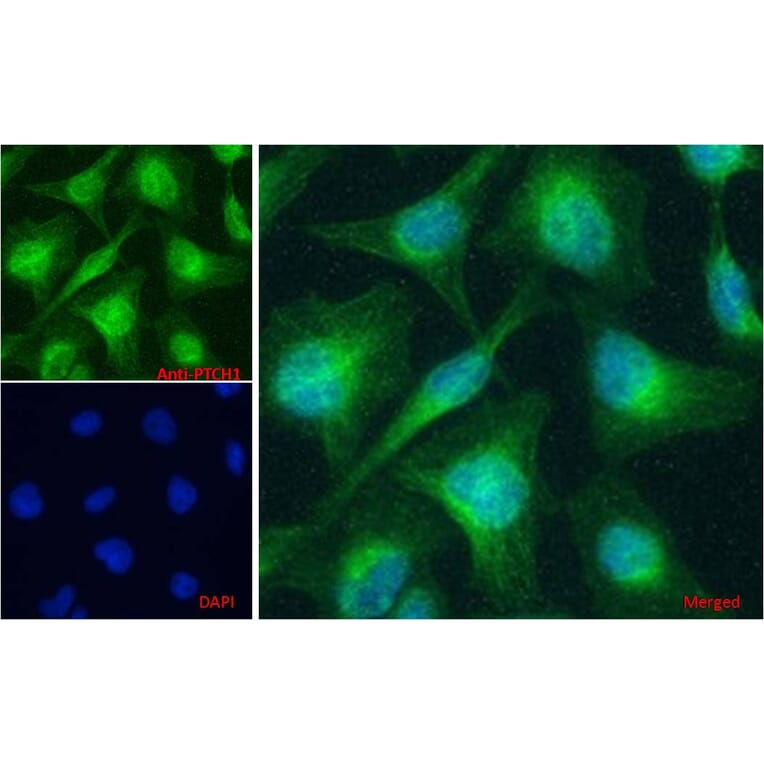 Immunofluorescence - Anti-Patched/PTCH1 Antibody (A83134) - Antibodies.com