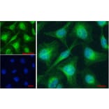 Immunofluorescence - Anti-Patched/PTCH1 Antibody (A83134) - Antibodies.com