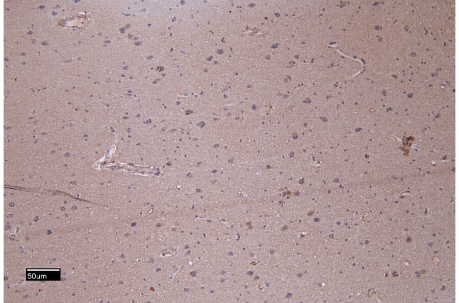 Immunohistochemistry - Anti-Patched/PTCH1 Antibody (A83134) - Antibodies.com