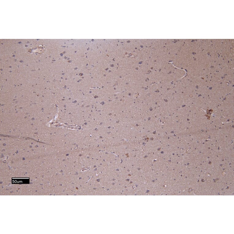 Immunohistochemistry - Anti-Patched/PTCH1 Antibody (A83134) - Antibodies.com
