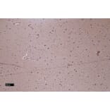 Immunohistochemistry - Anti-Patched/PTCH1 Antibody (A83134) - Antibodies.com