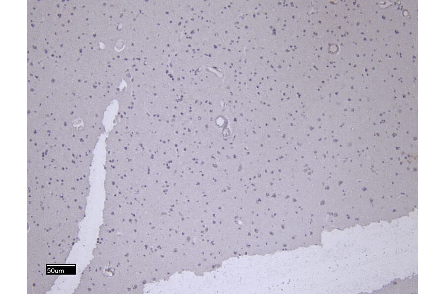 Immunohistochemistry - Anti-Patched/PTCH1 Antibody (A83134) - Antibodies.com