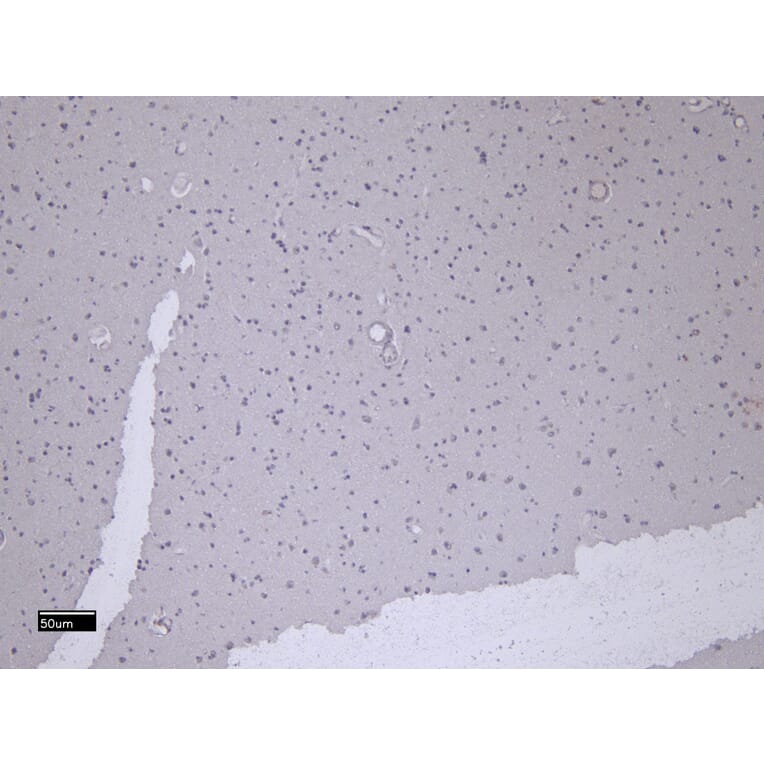 Immunohistochemistry - Anti-Patched/PTCH1 Antibody (A83134) - Antibodies.com
