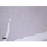 Immunohistochemistry - Anti-Patched/PTCH1 Antibody (A83134) - Antibodies.com