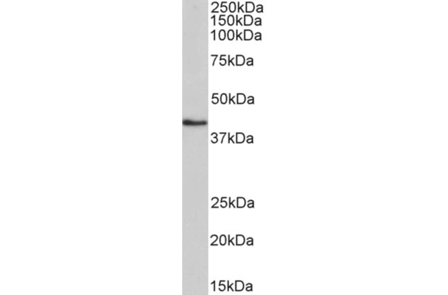 Western Blot - Anti-HMBS/PBGD Antibody (A83135) - Antibodies.com