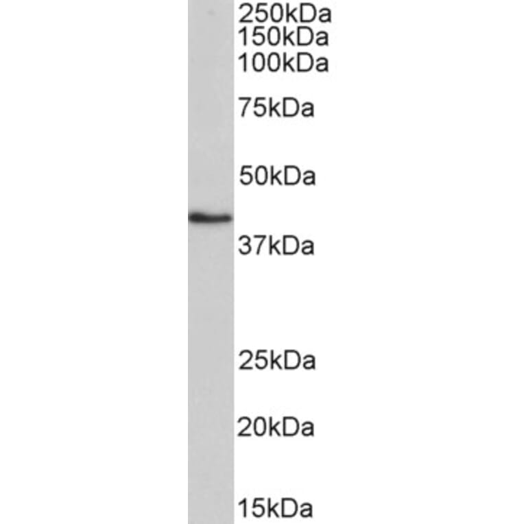 Western Blot - Anti-HMBS/PBGD Antibody (A83135) - Antibodies.com