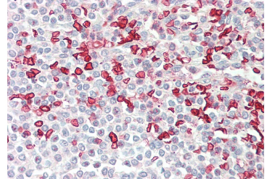 Immunohistochemistry - Anti-HMBS/PBGD Antibody (A83135) - Antibodies.com
