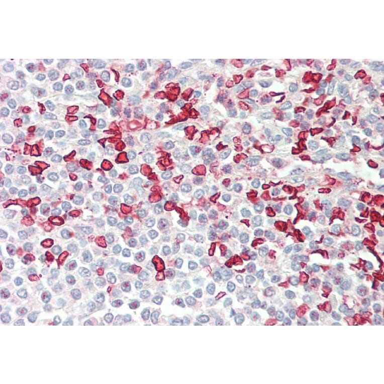 Immunohistochemistry - Anti-HMBS/PBGD Antibody (A83135) - Antibodies.com