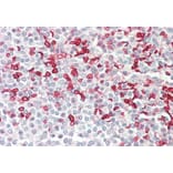 Immunohistochemistry - Anti-HMBS/PBGD Antibody (A83135) - Antibodies.com