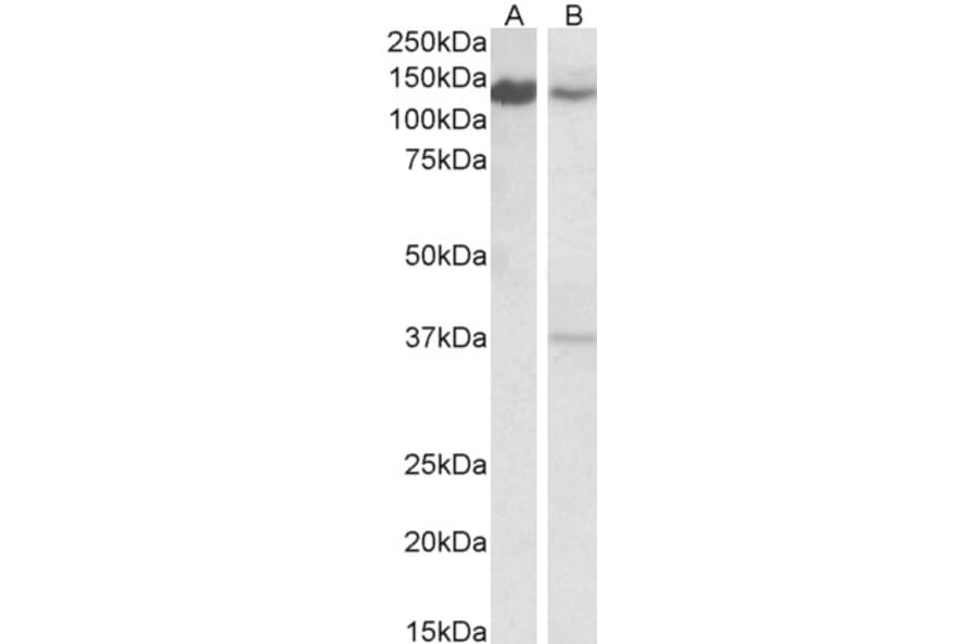 Western Blot - Anti-ARS2 Antibody (A83137) - Antibodies.com