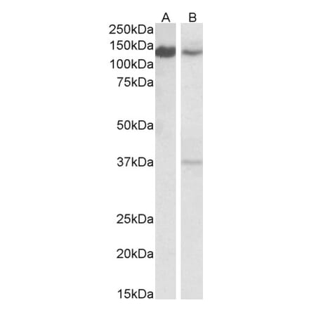 Western Blot - Anti-ARS2 Antibody (A83137) - Antibodies.com