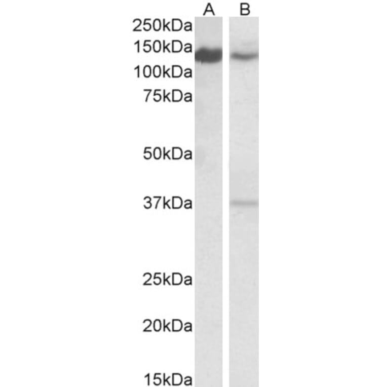 Western Blot - Anti-ARS2 Antibody (A83137) - Antibodies.com