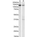 Western Blot - Anti-ARS2 Antibody (A83137) - Antibodies.com