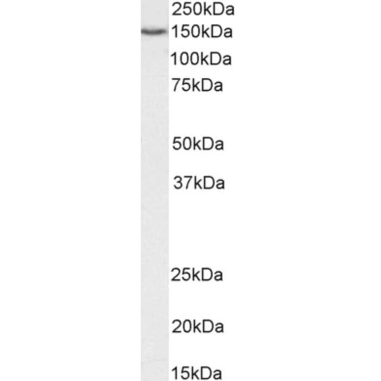 Western Blot - Anti-ARS2 Antibody (A83137) - Antibodies.com