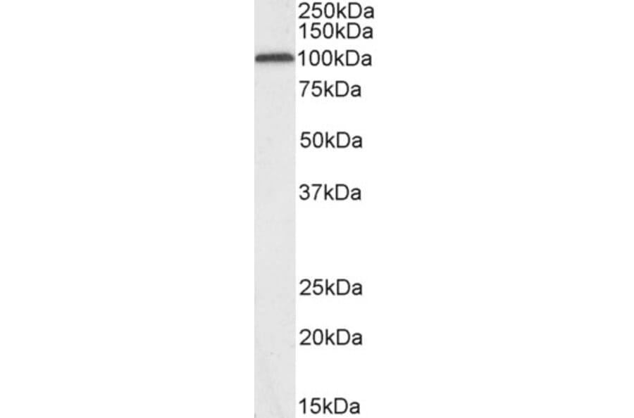 Western Blot - Anti-Glutamate Receptor 4 Antibody (A83139) - Antibodies.com