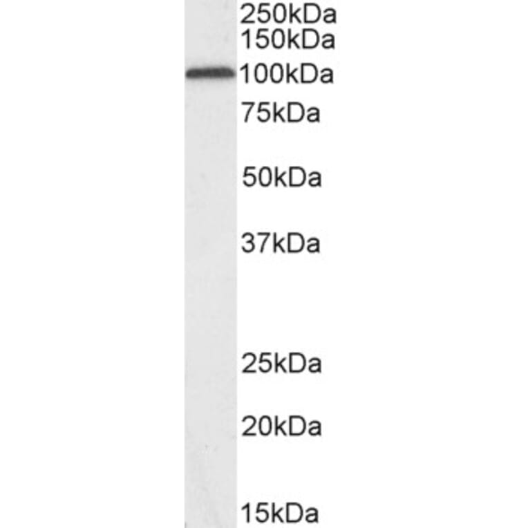 Western Blot - Anti-Glutamate Receptor 4 Antibody (A83139) - Antibodies.com