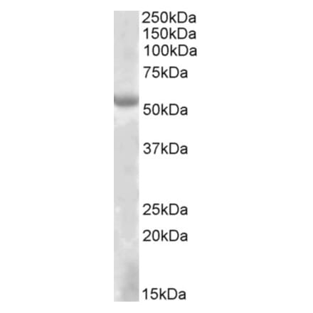 Western Blot - Anti-EYA1 Antibody (A83140) - Antibodies.com