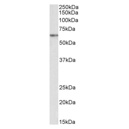 Western Blot - Anti-VRK2 Antibody (A83142) - Antibodies.com