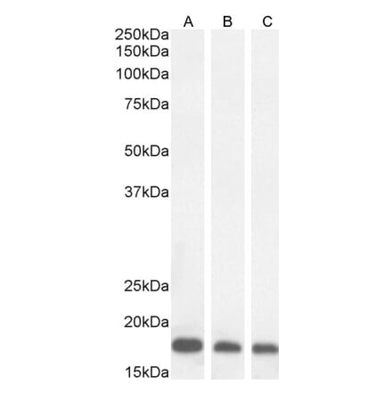 Western Blot - Anti-ARF1 Antibody (A83143) - Antibodies.com