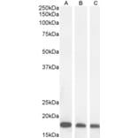 Western Blot - Anti-ARF1 Antibody (A83143) - Antibodies.com