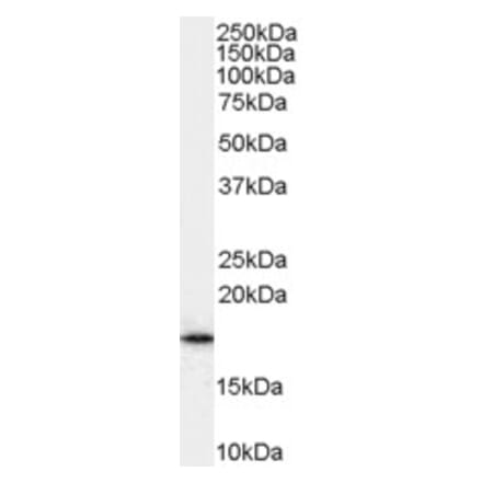 Western Blot - Anti-ARF1 Antibody (A83143) - Antibodies.com