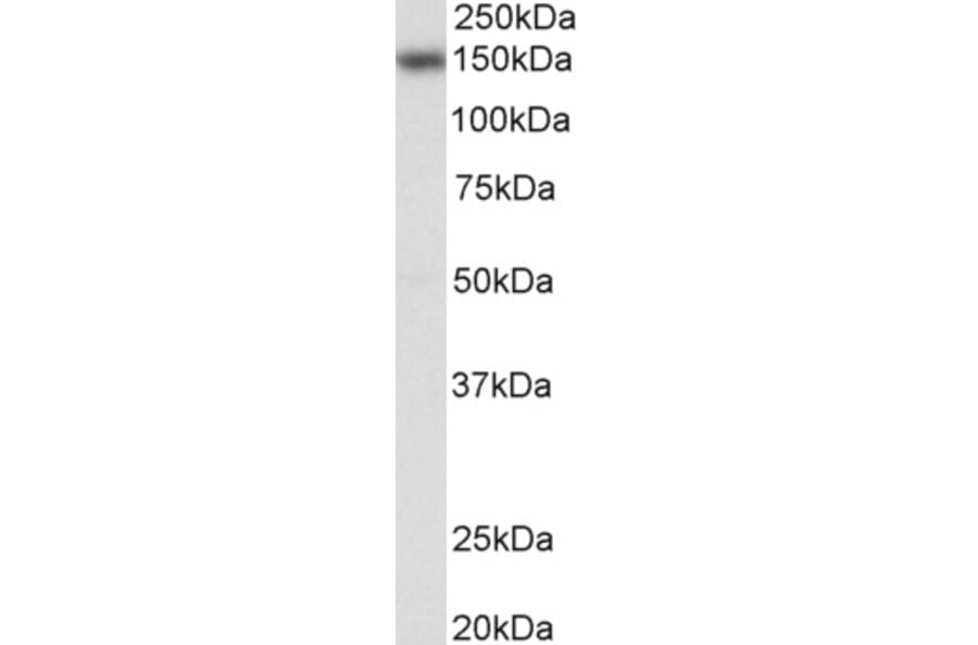 Western Blot - Anti-NFAT4/NF-ATc3 Antibody (A83144) - Antibodies.com