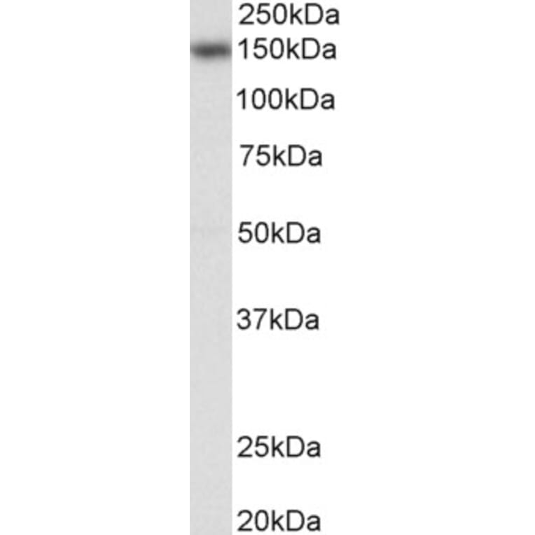 Western Blot - Anti-NFAT4/NF-ATc3 Antibody (A83144) - Antibodies.com