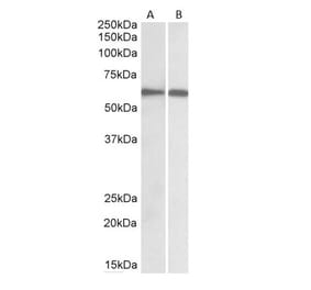 Western Blot - Anti-IRF5 Antibody (A83145) - Antibodies.com