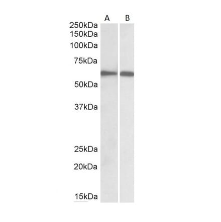 Western Blot - Anti-IRF5 Antibody (A83145) - Antibodies.com