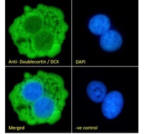 Immunofluorescence - Anti-Doublecortin Antibody (A83146) - Antibodies.com