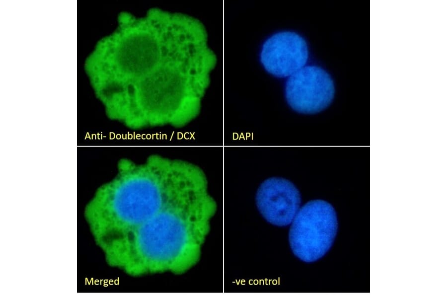 Immunofluorescence - Anti-Doublecortin Antibody (A83146) - Antibodies.com