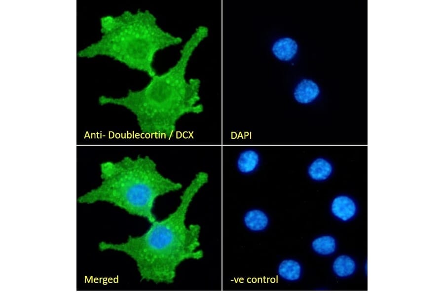 Immunofluorescence - Anti-Doublecortin Antibody (A83146) - Antibodies.com