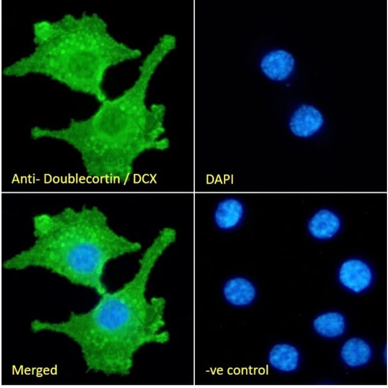 Immunofluorescence - Anti-Doublecortin Antibody (A83146) - Antibodies.com