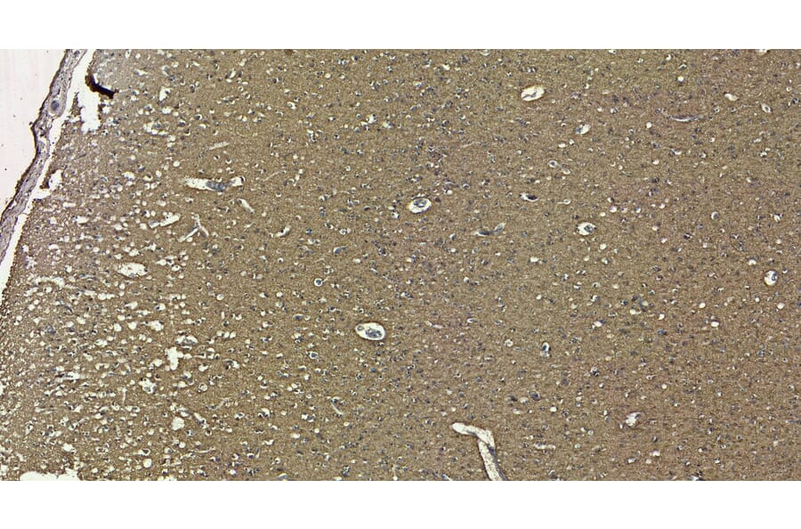 Immunohistochemistry - Anti-Doublecortin Antibody (A83146) - Antibodies.com