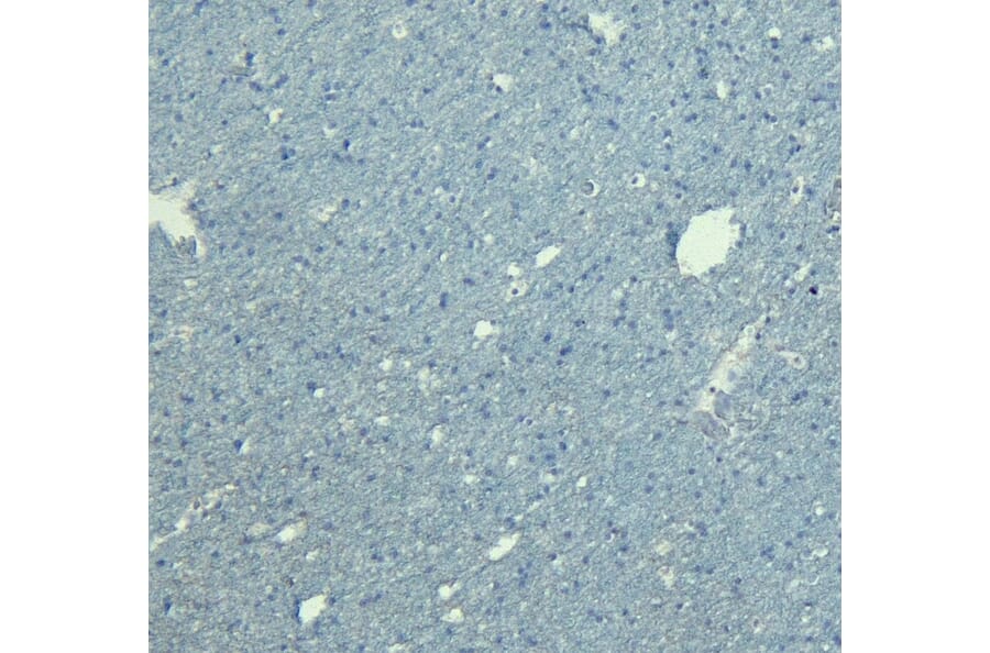 Immunohistochemistry - Anti-Doublecortin Antibody (A83146) - Antibodies.com