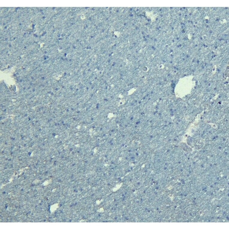 Immunohistochemistry - Anti-Doublecortin Antibody (A83146) - Antibodies.com