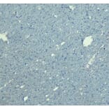 Immunohistochemistry - Anti-Doublecortin Antibody (A83146) - Antibodies.com