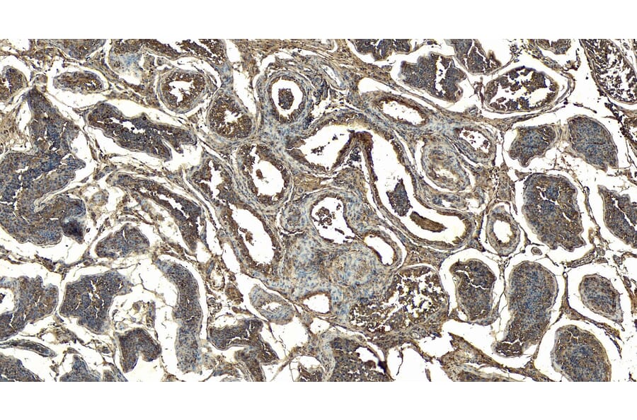 Immunohistochemistry - Anti-Doublecortin Antibody (A83146) - Antibodies.com
