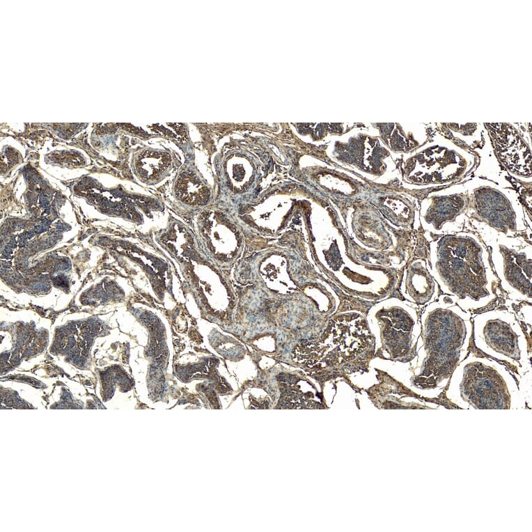 Immunohistochemistry - Anti-Doublecortin Antibody (A83146) - Antibodies.com