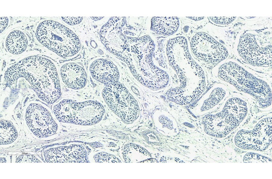 Immunohistochemistry - Anti-Doublecortin Antibody (A83146) - Antibodies.com