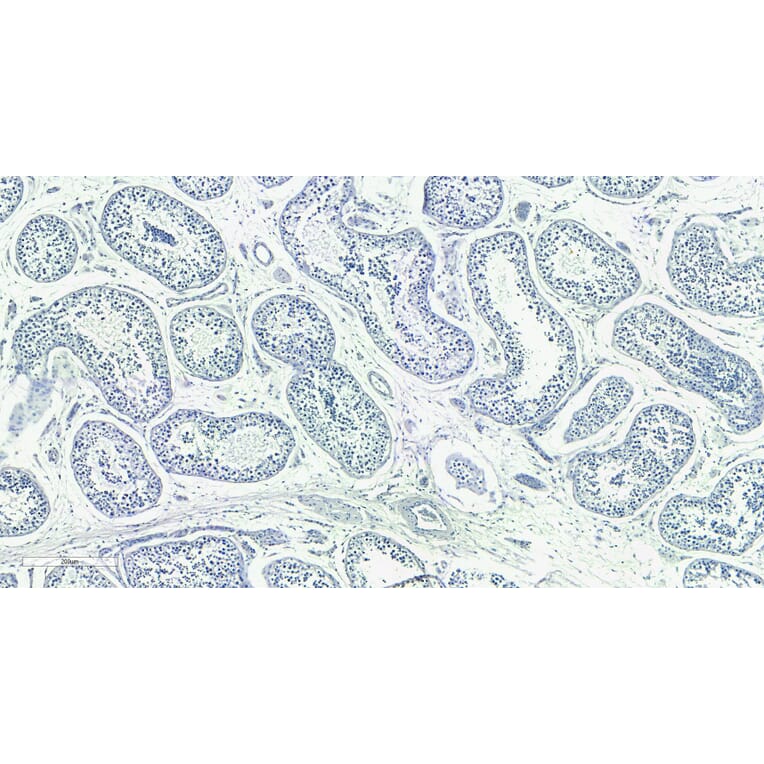 Immunohistochemistry - Anti-Doublecortin Antibody (A83146) - Antibodies.com