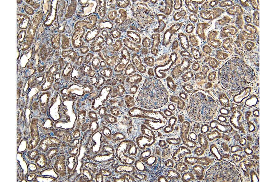 Immunohistochemistry - Anti-EWSR1/EWS Antibody (A83148) - Antibodies.com
