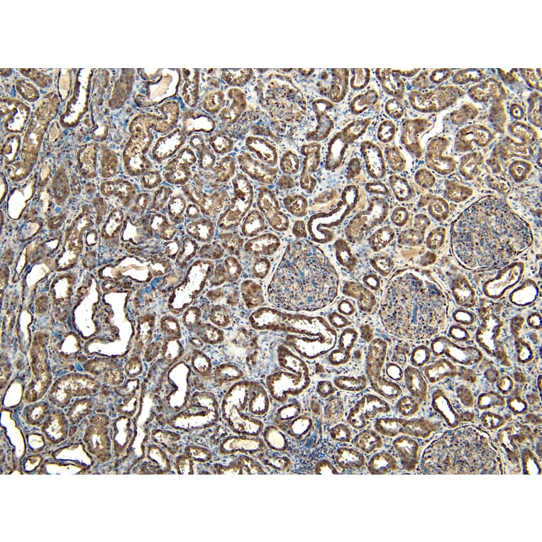Immunohistochemistry - Anti-EWSR1/EWS Antibody (A83148) - Antibodies.com