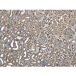 Immunohistochemistry - Anti-EWSR1/EWS Antibody (A83148) - Antibodies.com