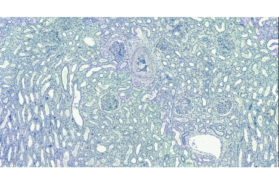 Immunohistochemistry - Anti-EWSR1/EWS Antibody (A83148) - Antibodies.com